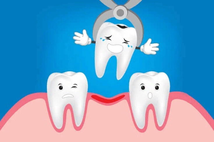 Показания для удаления зуба!